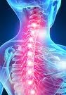 Bolesti krčnej chrbtice