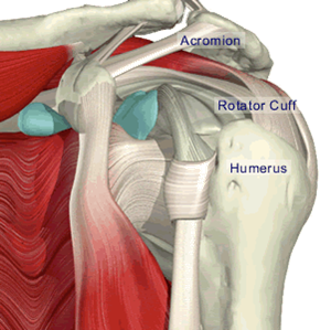 osteoartroza ramena